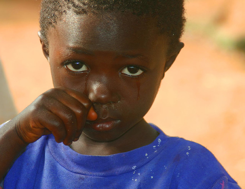 フリー画像|人物写真|子供ポートレイト|少年/男の子|外国の子供|アフリカの子供|泣き顔|シエラレオネ共和国人|