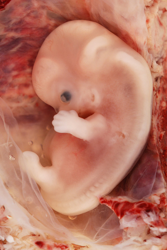 フリー画像|人物写真|胚/胚子|妊娠から9週間後の人間の胚|赤ちゃん|フリー素材|
