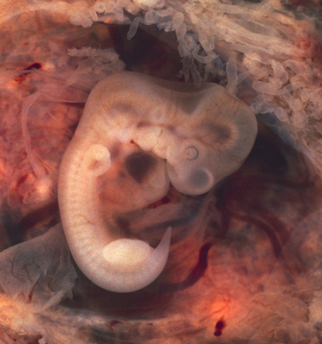 フリー画像|人物写真|胚/胚子|妊娠から7週間後の人間の胚|赤ちゃん|フリー素材|